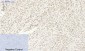 Bcl-6 Polyclonal Antibody